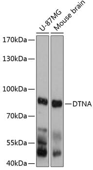 Western blot analysis of extracts of various cell lines, using Anti-DTNA Antibody (A12067) at 1:3000 dilution.
Secondary antibody: Goat Anti-Rabbit IgG (H+L) (HRP) (AS014) at 1:10,000 dilution.
Lysates / proteins: 25µg per lane.
Blocking buffer: 3% non-fat dry milk in TBST.
Detection: ECL Basic Kit (RM00020).
Exposure time: 10s.