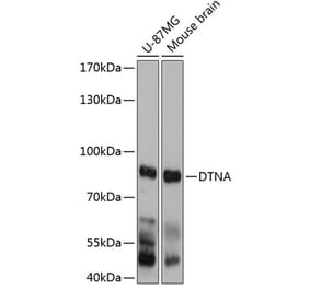 Western Blot - Anti-DTN-A Antibody (A81117) - Antibodies.com