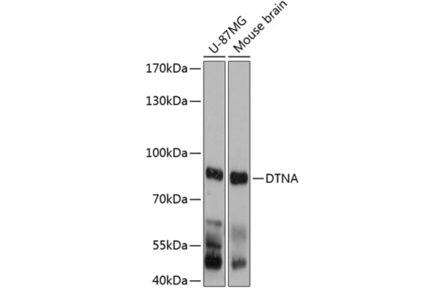 Western Blot - Anti-DTN-A Antibody (A81117) - Antibodies.com