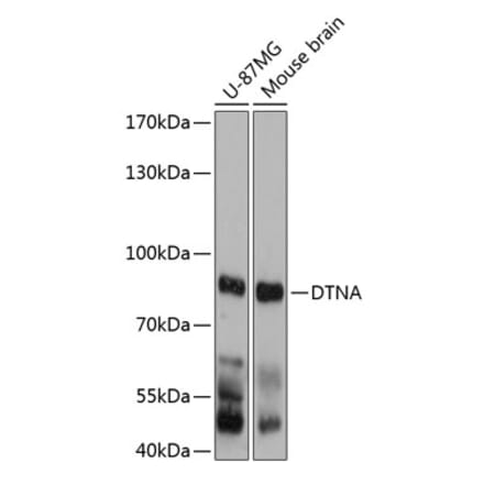Western Blot - Anti-DTN-A Antibody (A81117) - Antibodies.com