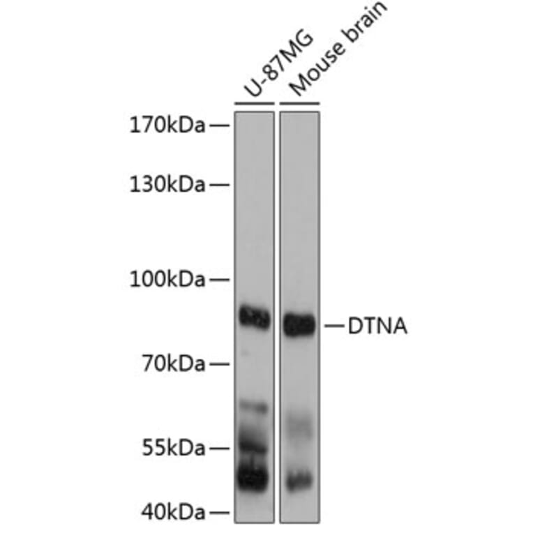 Western Blot - Anti-DTN-A Antibody (A81117) - Antibodies.com