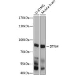 Western Blot - Anti-DTN-A Antibody (A81117) - Antibodies.com