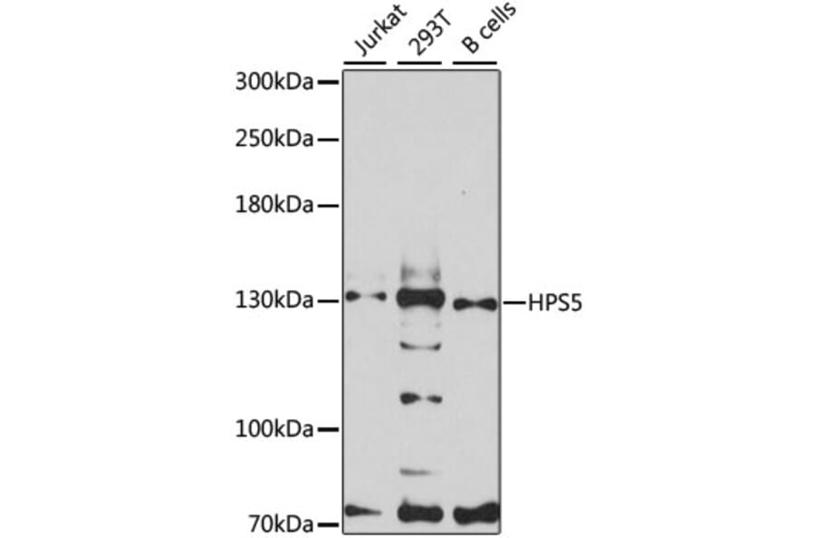 Western Blot - Anti-HPS5 Antibody (A12079) - Antibodies.com