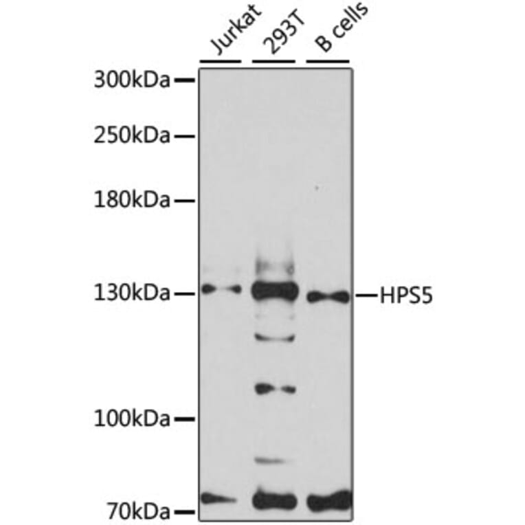 Western Blot - Anti-HPS5 Antibody (A12079) - Antibodies.com