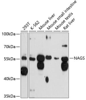 Western blot analysis of extracts of various cell lines, using Anti-NAGS Antibody (A12086) at 1:3000 dilution.
Secondary antibody: Goat Anti-Rabbit IgG (H+L) (HRP) (AS014) at 1:10,000 dilution.
Lysates / proteins: 25µg per lane.
Blocking buffer: 3% non-fat dry milk in TBST.
Detection: ECL Basic Kit (RM00020).
Exposure time: 90s.