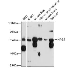 Western Blot - Anti-NAGS Antibody (A81119) - Antibodies.com