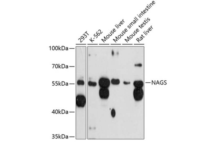 Western Blot - Anti-NAGS Antibody (A81119) - Antibodies.com