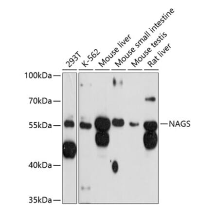 Western Blot - Anti-NAGS Antibody (A81119) - Antibodies.com