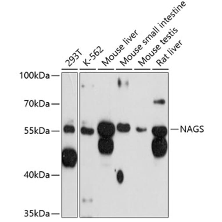 Western Blot - Anti-NAGS Antibody (A81119) - Antibodies.com