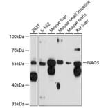 Western Blot - Anti-NAGS Antibody (A81119) - Antibodies.com