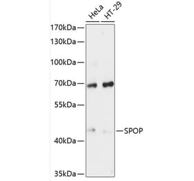 Western Blot - Anti-SPOP Antibody (A81120) - Antibodies.com