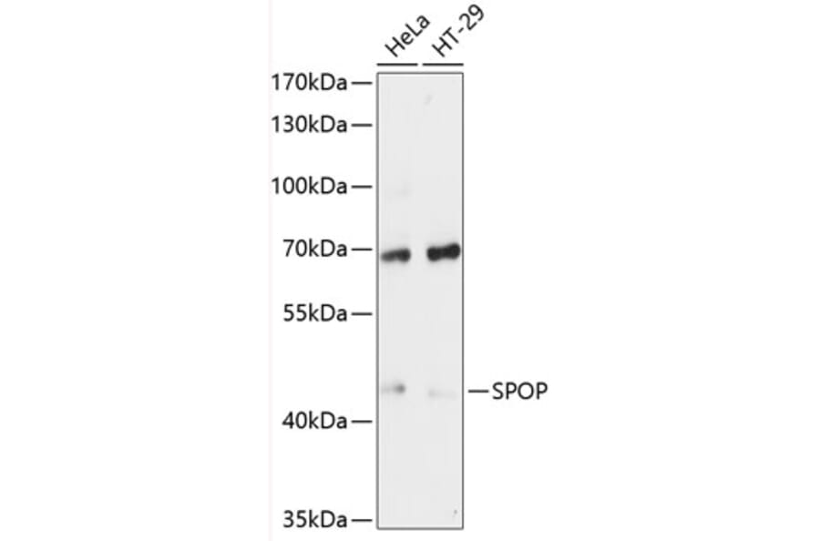Western Blot - Anti-SPOP Antibody (A81120) - Antibodies.com