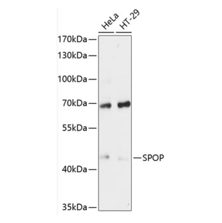 Western Blot - Anti-SPOP Antibody (A81120) - Antibodies.com