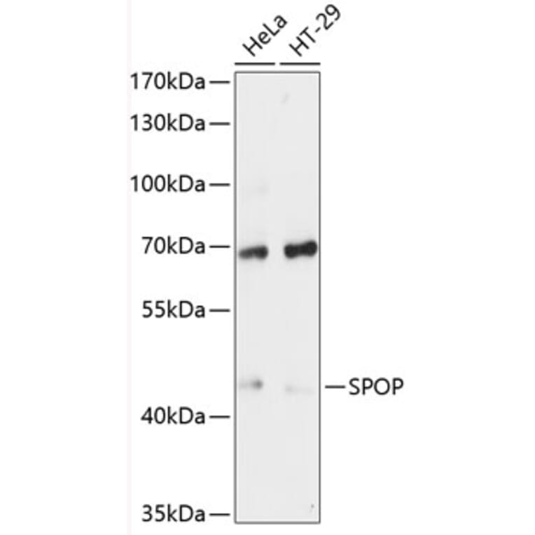 Western Blot - Anti-SPOP Antibody (A81120) - Antibodies.com