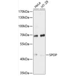 Western Blot - Anti-SPOP Antibody (A81120) - Antibodies.com