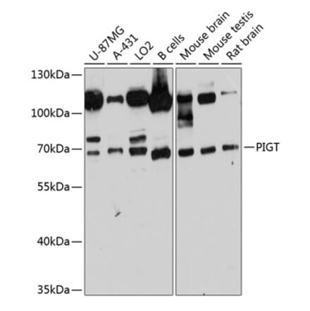 Western Blot - Anti-PIGT Antibody (A81121) - Antibodies.com