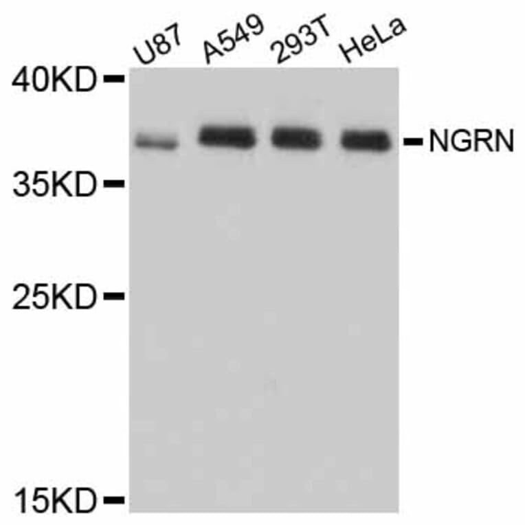Western Blot - Anti-NGRN Antibody (A12131) - Antibodies.com