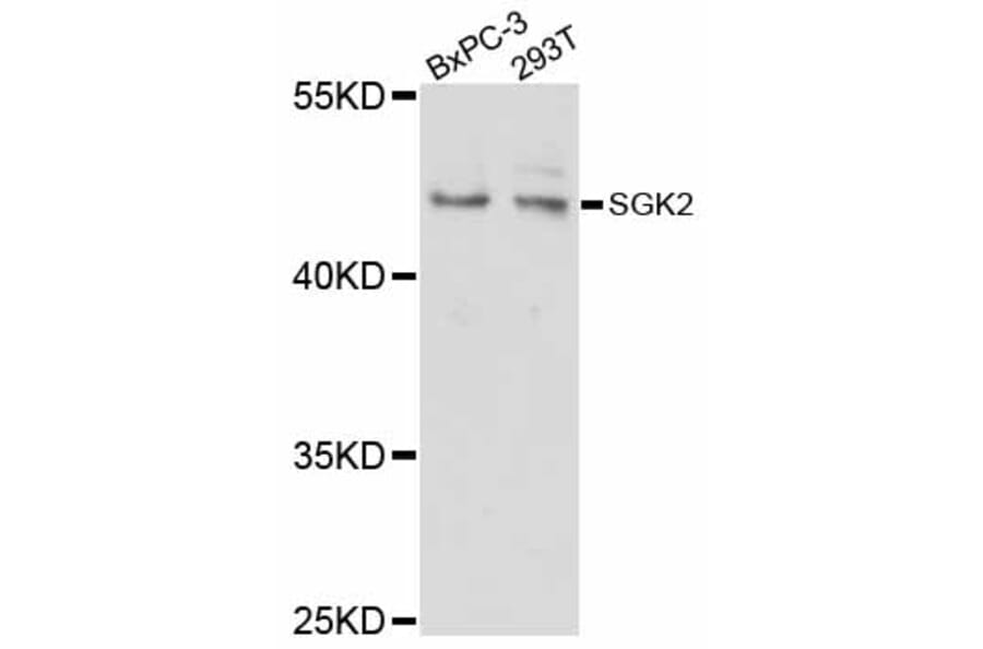 Western Blot - Anti-SGK2 Antibody (A12137) - Antibodies.com