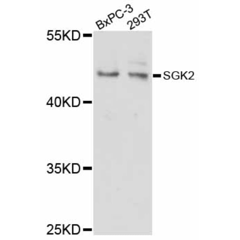 Western Blot - Anti-SGK2 Antibody (A12137) - Antibodies.com