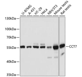 Western Blot - Anti-TCP1 eta Antibody (A81124) - Antibodies.com