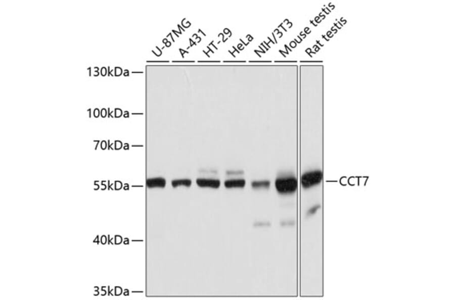 Western Blot - Anti-TCP1 eta Antibody (A81124) - Antibodies.com