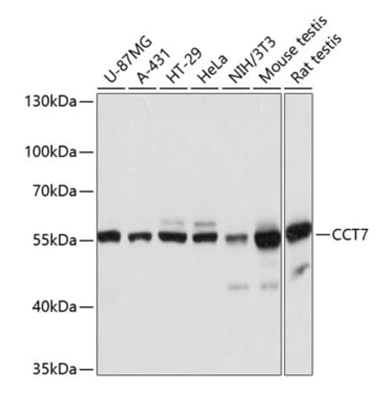 Western Blot - Anti-TCP1 eta Antibody (A81124) - Antibodies.com