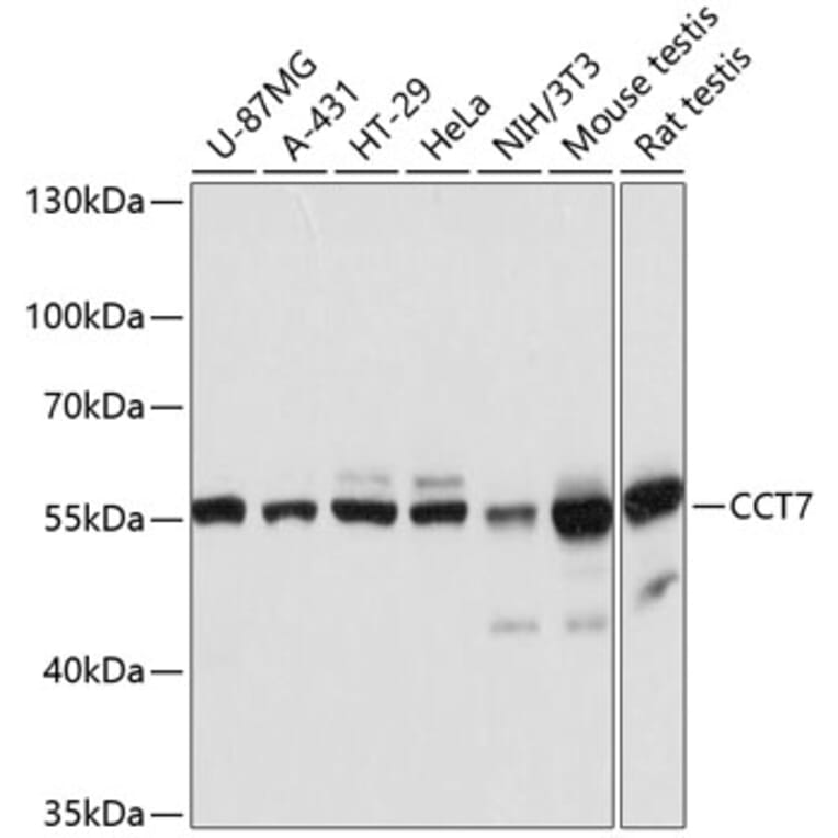 Western Blot - Anti-TCP1 eta Antibody (A81124) - Antibodies.com