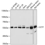 Western Blot - Anti-TCP1 eta Antibody (A81124) - Antibodies.com