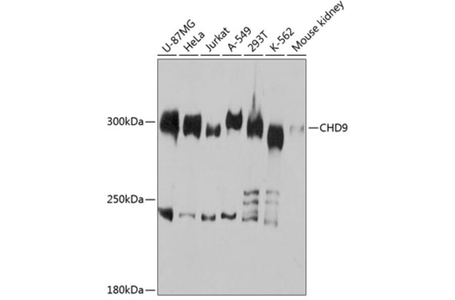 Western Blot - Anti-Chromodomain helicase DNA binding protein 9 Antibody (A81125) - Antibodies.com