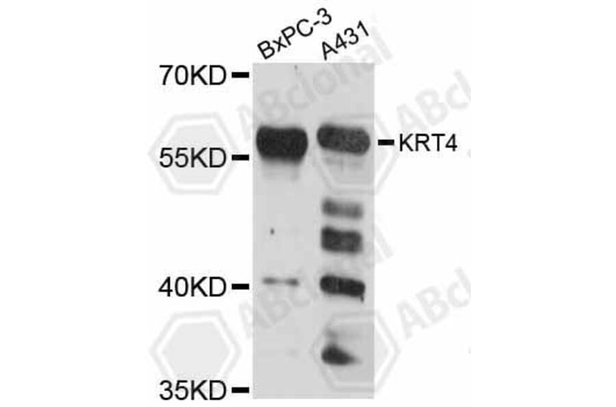 Western Blot - Anti-KRT4 Antibody (A12156) - Antibodies.com