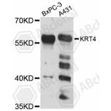 Western Blot - Anti-KRT4 Antibody (A12156) - Antibodies.com