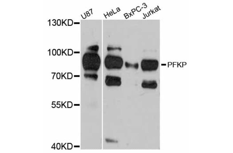 Western Blot - Anti-PFKP Antibody (A12160) - Antibodies.com