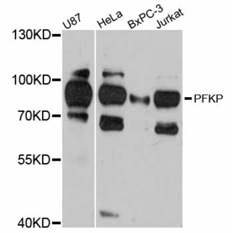 Western Blot - Anti-PFKP Antibody (A12160) - Antibodies.com