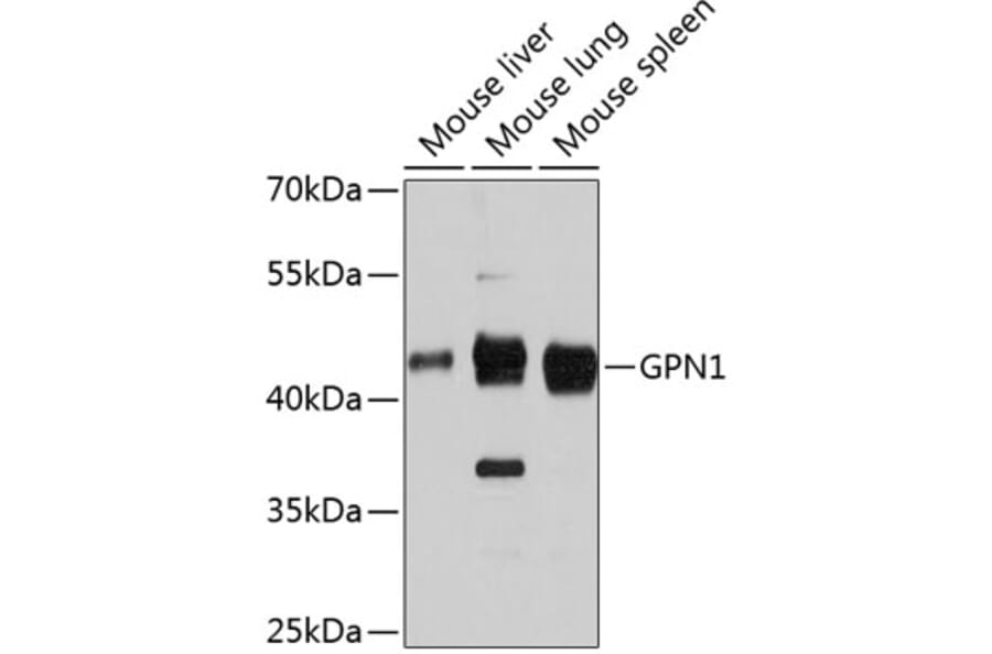 Western Blot - Anti-XAB1/GPN1 Antibody (A81130) - Antibodies.com