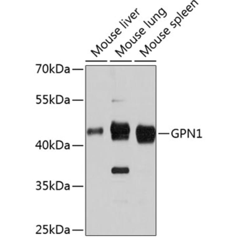 Western Blot - Anti-XAB1/GPN1 Antibody (A81130) - Antibodies.com