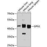 Western Blot - Anti-XAB1/GPN1 Antibody (A81130) - Antibodies.com