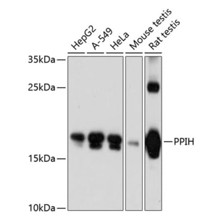 Western Blot - Anti-PPIH Antibody (A81131) - Antibodies.com
