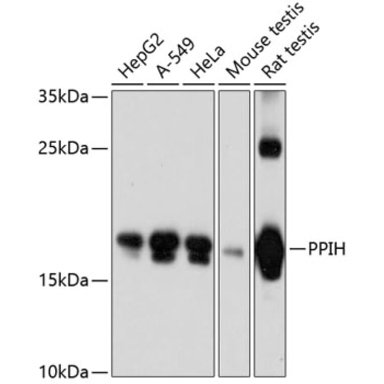 Western Blot - Anti-PPIH Antibody (A81131) - Antibodies.com