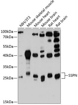 Western blot analysis of extracts of various cell lines, using Anti-SSPN Antibody (A12191) at 1:3000 dilution.
Secondary antibody: Goat Anti-Rabbit IgG (H+L) (HRP) (AS014) at 1:10,000 dilution.
Lysates / proteins: 25µg per lane.
Blocking buffer: 3% non-fat dry milk in TBST.
Detection: ECL Basic Kit (RM00020).
Exposure time: 90s.