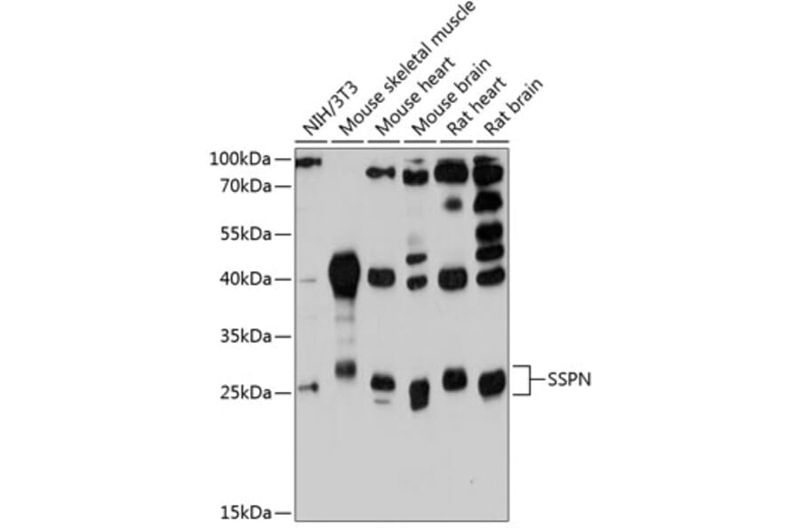 Western Blot - Anti-SSPN Antibody (A81133) - Antibodies.com