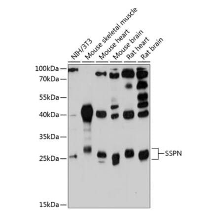 Western Blot - Anti-SSPN Antibody (A81133) - Antibodies.com
