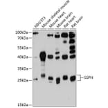 Western Blot - Anti-SSPN Antibody (A81133) - Antibodies.com