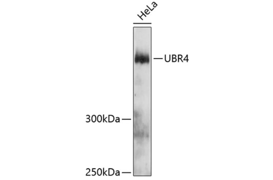 Western Blot - Anti-UBR4/p600 Antibody (A81134) - Antibodies.com