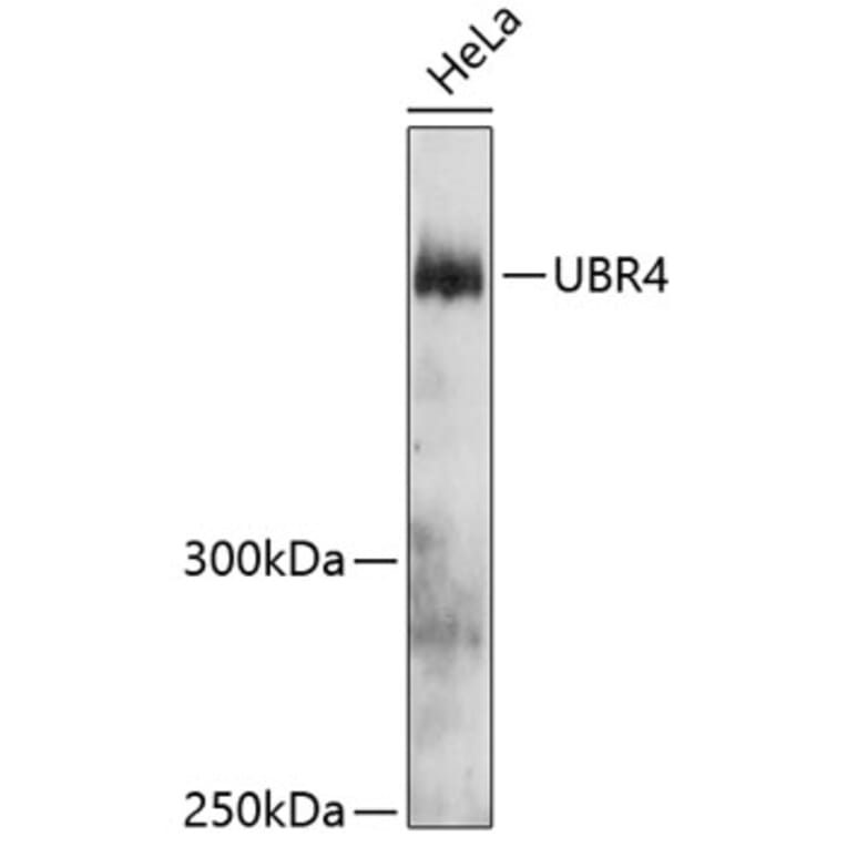 Western Blot - Anti-UBR4/p600 Antibody (A81134) - Antibodies.com