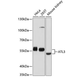 Western Blot - Anti-ATL3 Antibody (A81136) - Antibodies.com