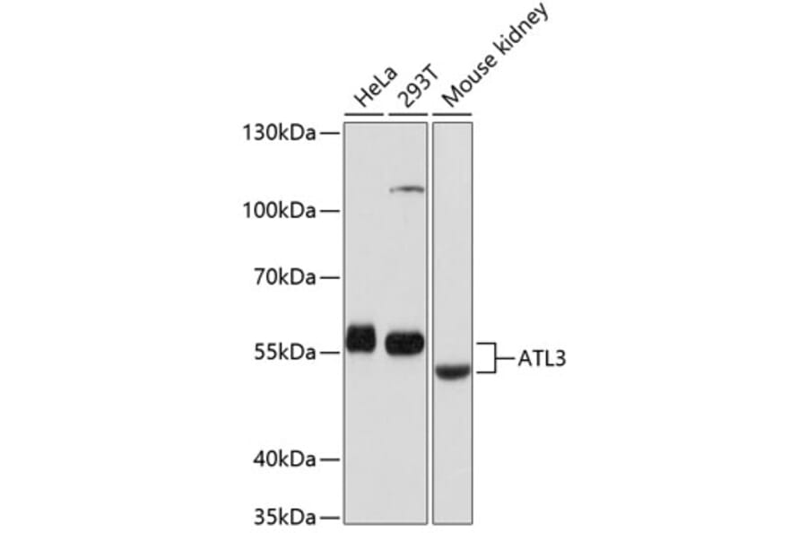 Western Blot - Anti-ATL3 Antibody (A81136) - Antibodies.com