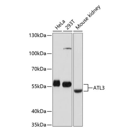 Western Blot - Anti-ATL3 Antibody (A81136) - Antibodies.com