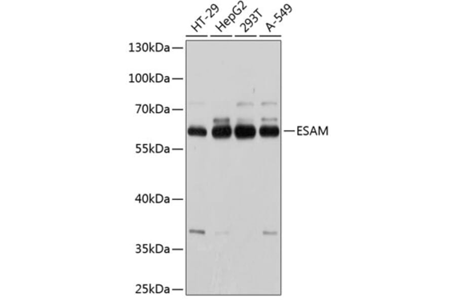 Western Blot - Anti-ESAM Antibody (A81137) - Antibodies.com