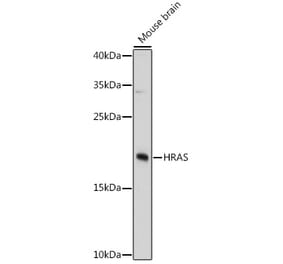 Western Blot - Anti-GTPase HRAS Antibody (A81138) - Antibodies.com