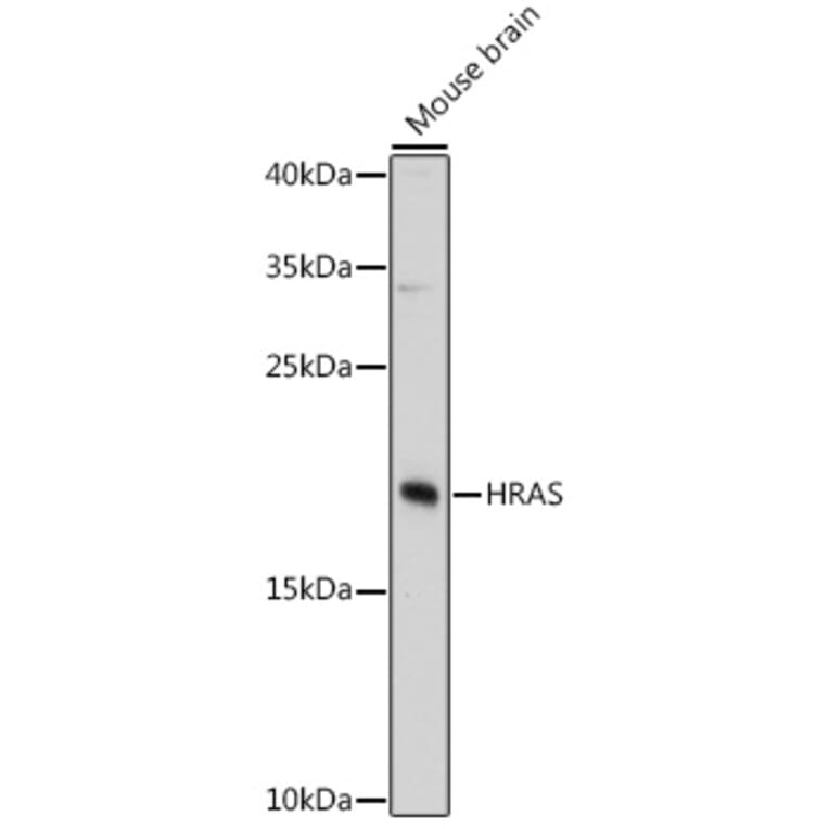 Western Blot - Anti-GTPase HRAS Antibody (A81138) - Antibodies.com